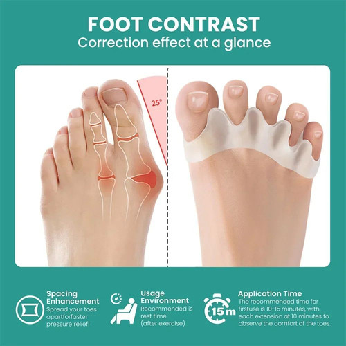 Gel toe separator stretcher - toe,