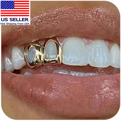 Gold grills for your teeth - gold,