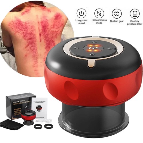 Smart electric cupping - cupping, therapy
