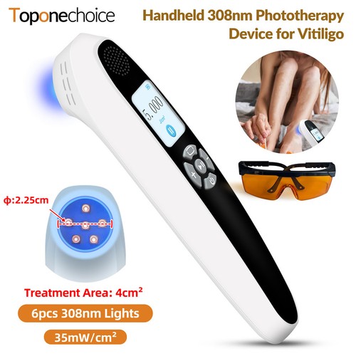 308nm ultraviolet light - 308nm,