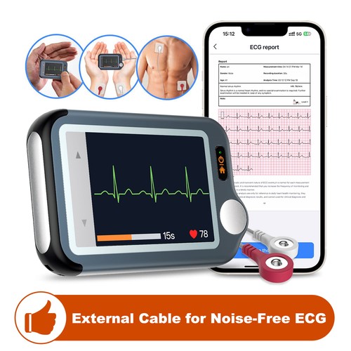 Checkme bluetooth ekg - checkme,