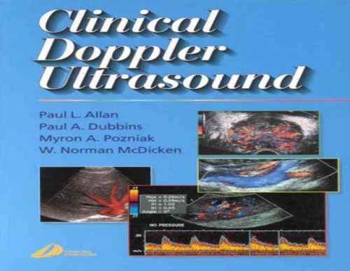 Clinical doppler ultrasound - doppler,