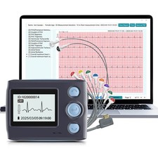 12 Lead Holter Monitor