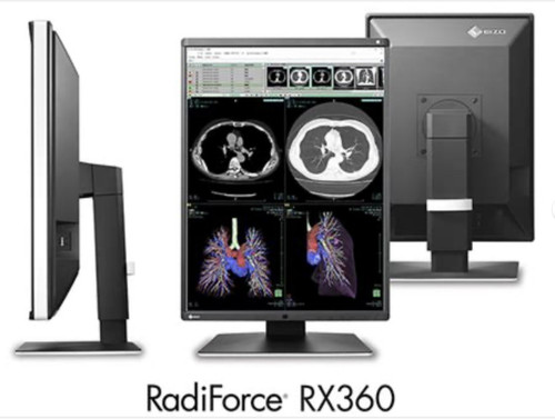 Eizo radiforce monitor - eizo,