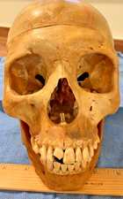 Real Human Skull Bone Antique Genuine anatomical model surgical neurosurg Kilgor