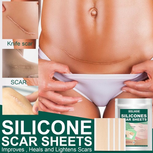 Silicone scar sheet gel - sheet,