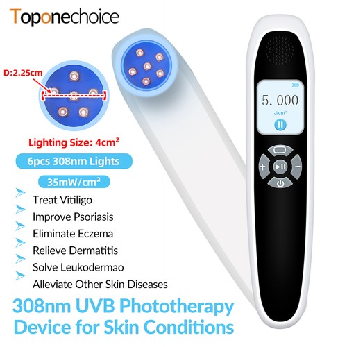 Handheld 308nm narrowband - 308nm,