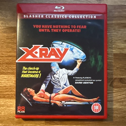 Ray a hospital massacre - x-ray, a.k.a