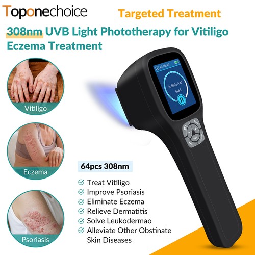 308nm uvb phototherapy lamp - phototherapy,