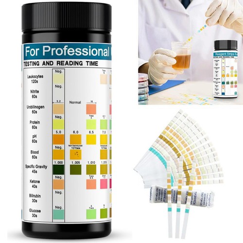 100pcs urinalysis urine - 100pcs, test