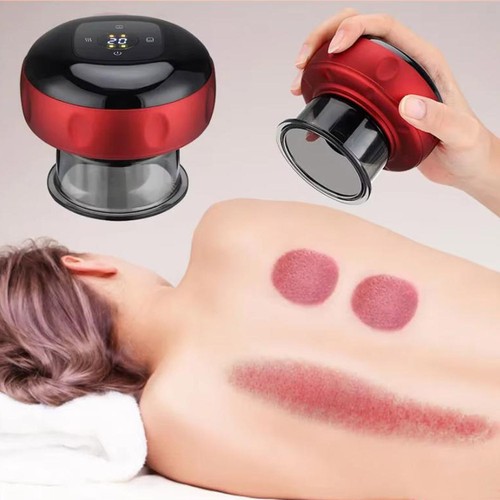 Electric vacuum cupping - electric,