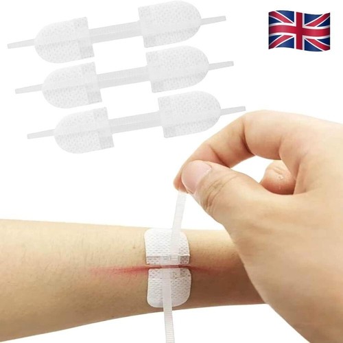 Zip stitch wound closure - wound,