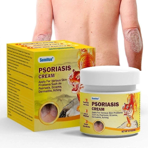 Psoriasis cream antifungal - psoriasis,
