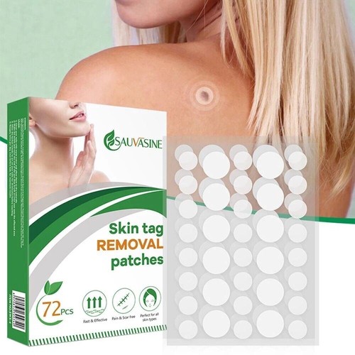 New skin tag - new,