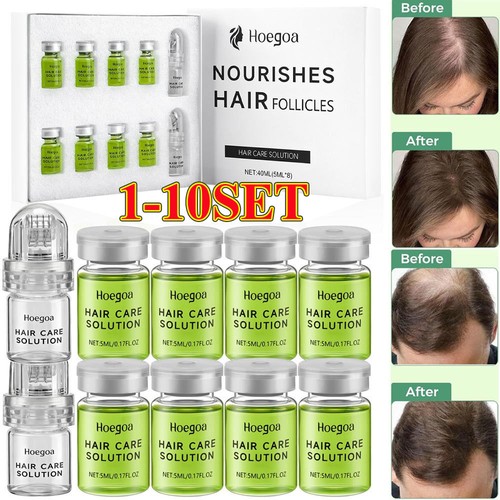 Micro infuse hair - infuse,