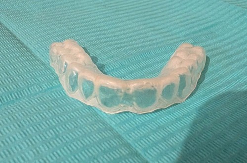 Custom fit teeth grinding - teeth,