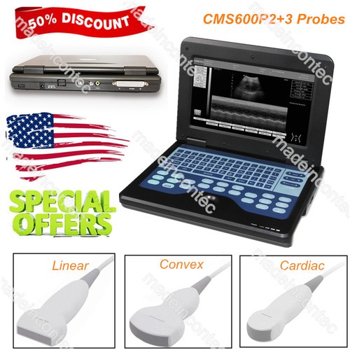 Portable ultrasound scanner - portable,