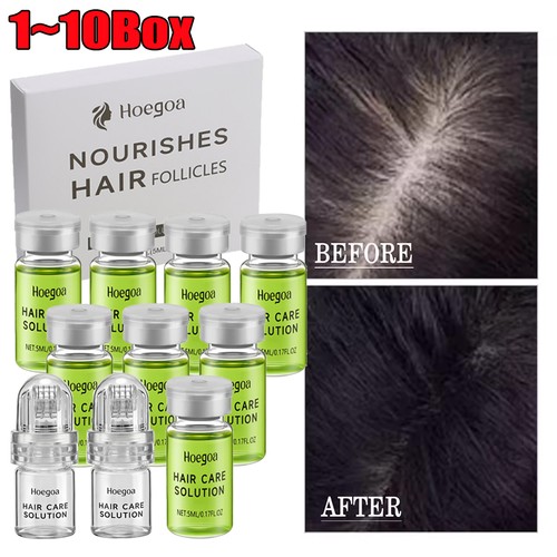 Micro infusion hair regrowth - micro,