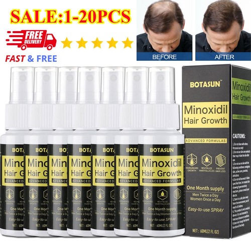 Minoxidil spray serum - minoxidil,