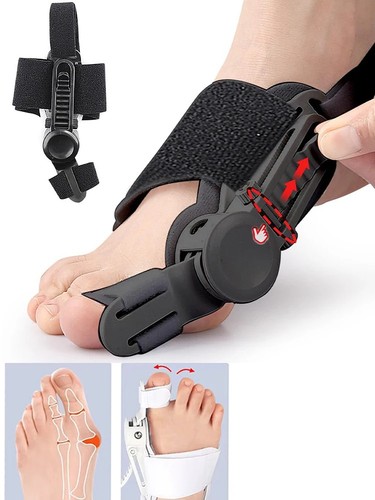 Nhs adjustable hallux valgus - hallux,