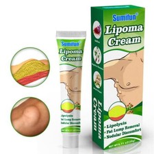 Lipomas Cream Antibacterial Cleansing Cellulite Fat Lump-Sell Removal 20g A9W6