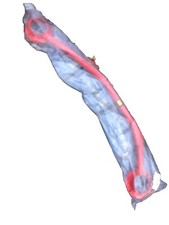 Omp 1681 front strut brace - omp,