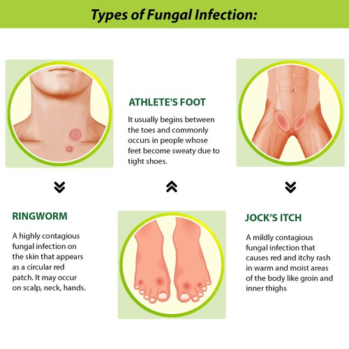 Tetmosol anti fungal dusting - tetmosol,