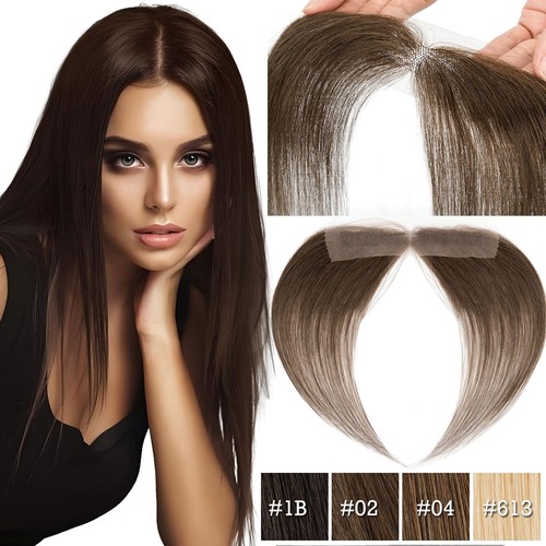 Front hairline hair patch bald - front,