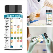 100Pcs Urinalysis Urine Test