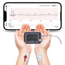 Home EKG Monitor with External