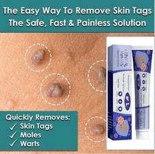 Skin Tag Mole Wart Remover