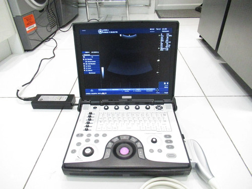 Logiq 4d ultrasound - ge,