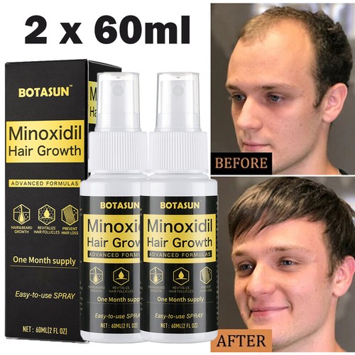 Pack minoxidil hair - 5%,