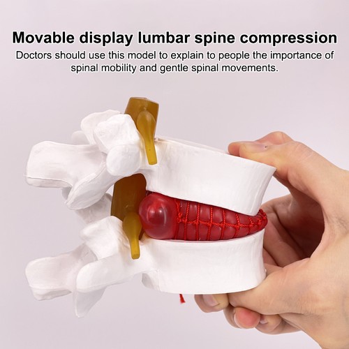 Lumbar model human anatomy - lumbar,