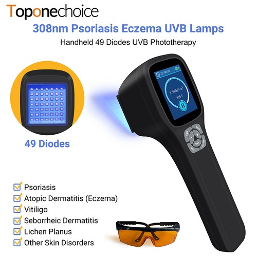 308nm phototherapy narrowband - 308nm,