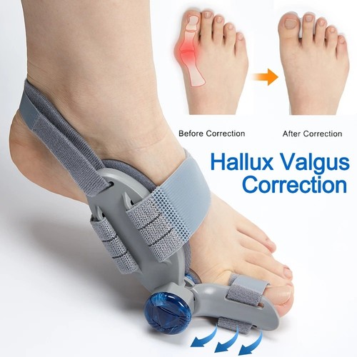 Adjustable hallux valgus - hallux,