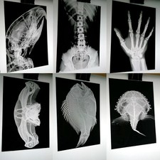 X-RAY imaged onto photographic