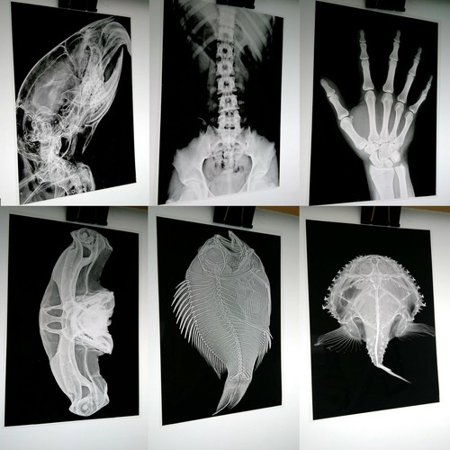 Ray imaged onto photographic - x-ray,