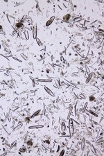 Antique microscope slide by J.T.Norman. "Diatoms from Rumney Peat. 1844".