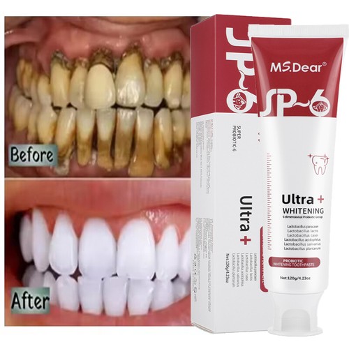 Probiotic toothpaste - probiotic,