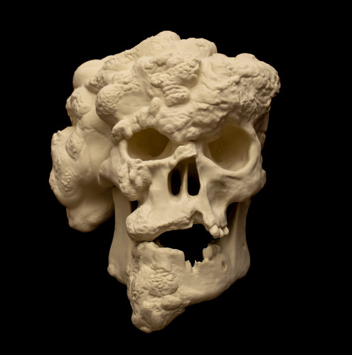 Joseph merrick skull - merrick,