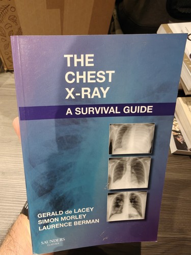 Chest ray survival - survival, guide