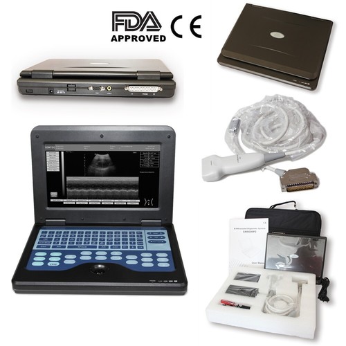 Approved digital ultrasound - ce,