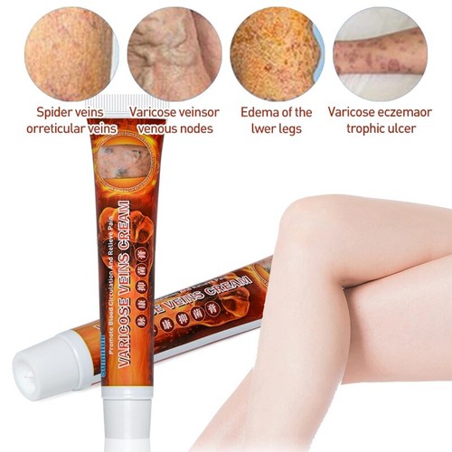 100 original vasculitis - 100%original,
