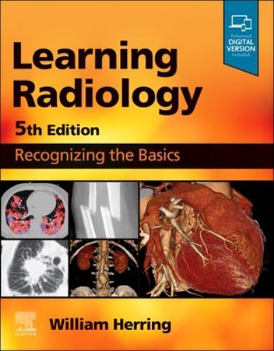 Learning radiology - learning,