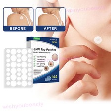 144 Pcs Skin Tag Remover Patches Effective Mole Warts Removal Sticker Quick Pad