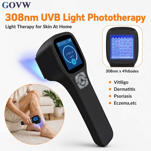 Handheld 308nm uvb therapy - handheld,