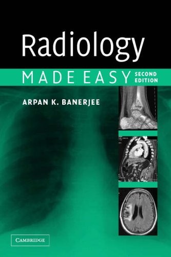 Radiology made easy arpan - easy-arpan, k