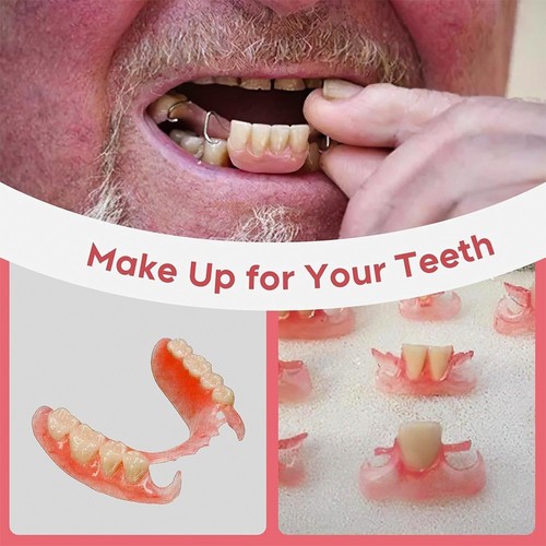 Diy denture fake - diy, teeth