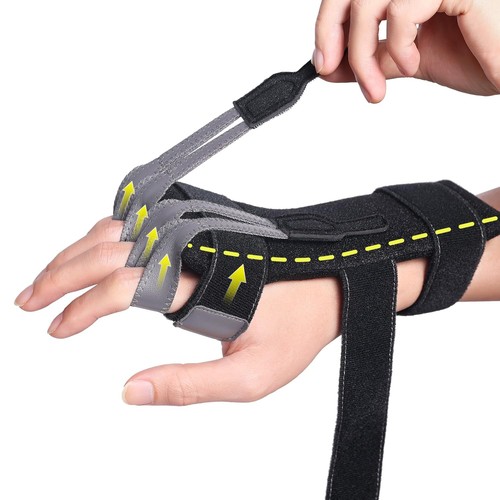 Radial nerve splint - radial, wrist
